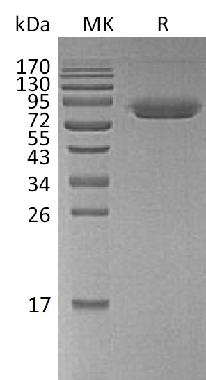 Biotinylated Human CD47 +SDS-PAGE-1.jpg